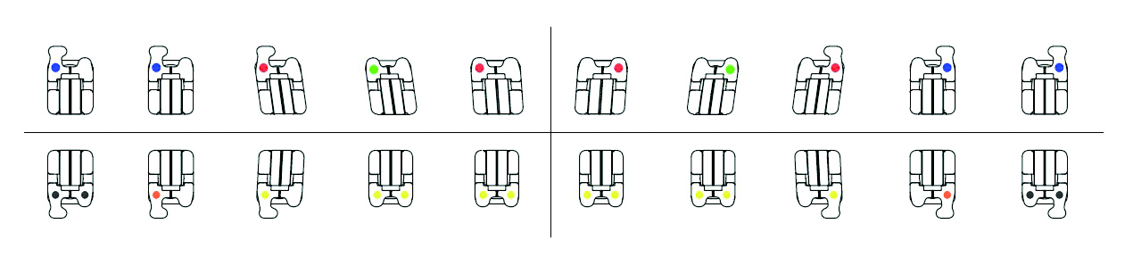 CePassTM Pro SL Brackets, einzeln