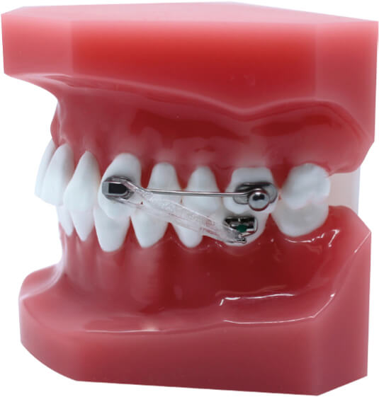 D2  non-latex Elastics 1/4“, 8.5 OZ (Level 2)