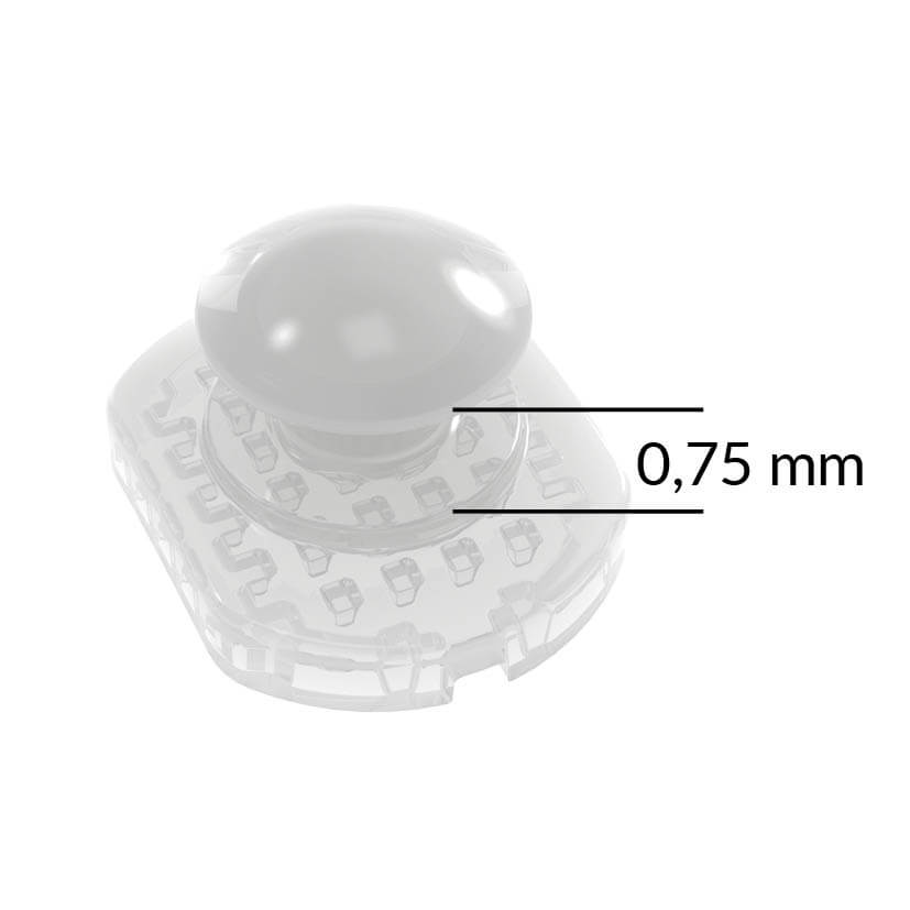 Ceramic Lingual Button