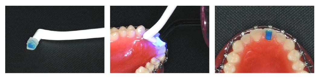 Band Zement "BLUE" Spritze